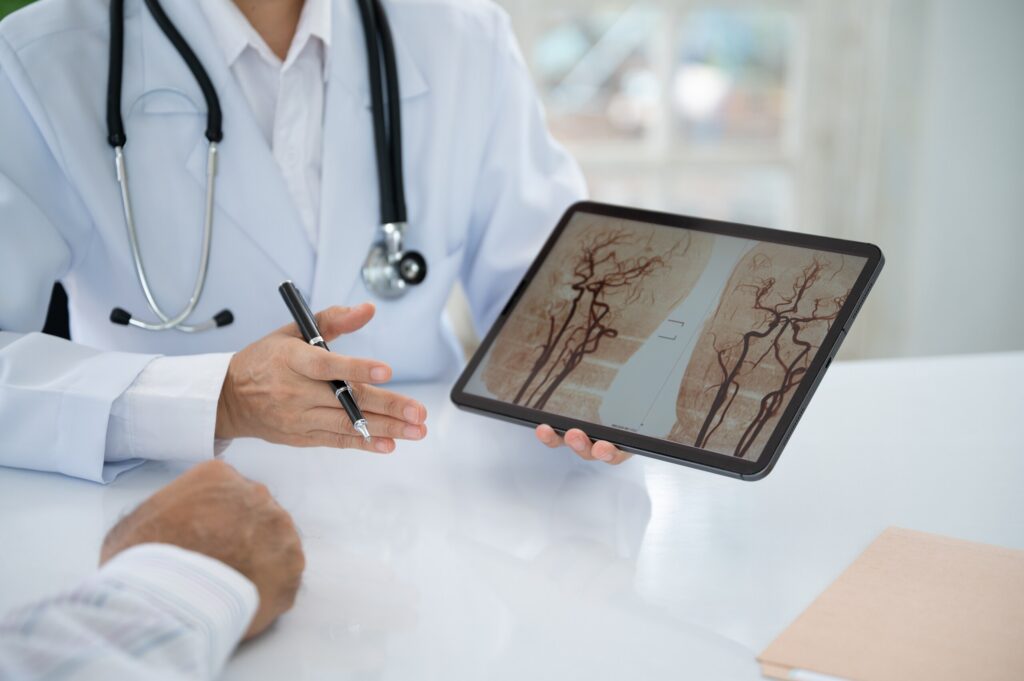 A doctor in a lab coat and stethoscope points to a tablet screen displaying a vascular brain scan for a patient, illustrating medical evidence used by Broward County Traumatic Brain Injury Lawyers.