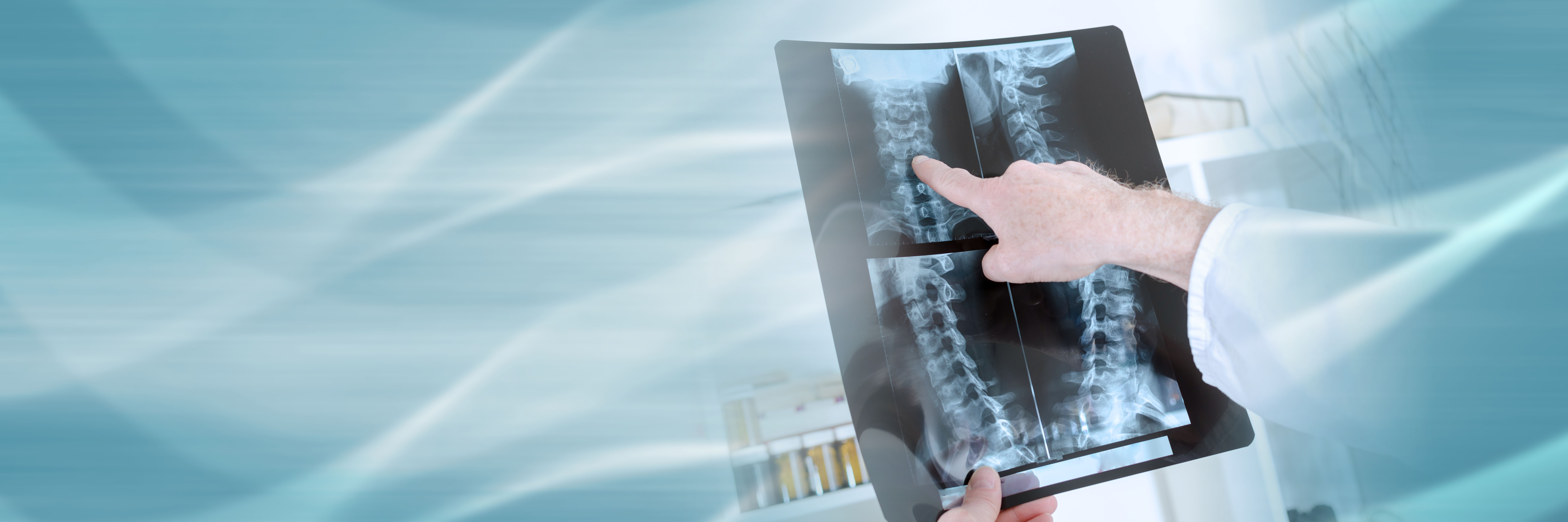 Medical professional pointing to a spinal X-ray