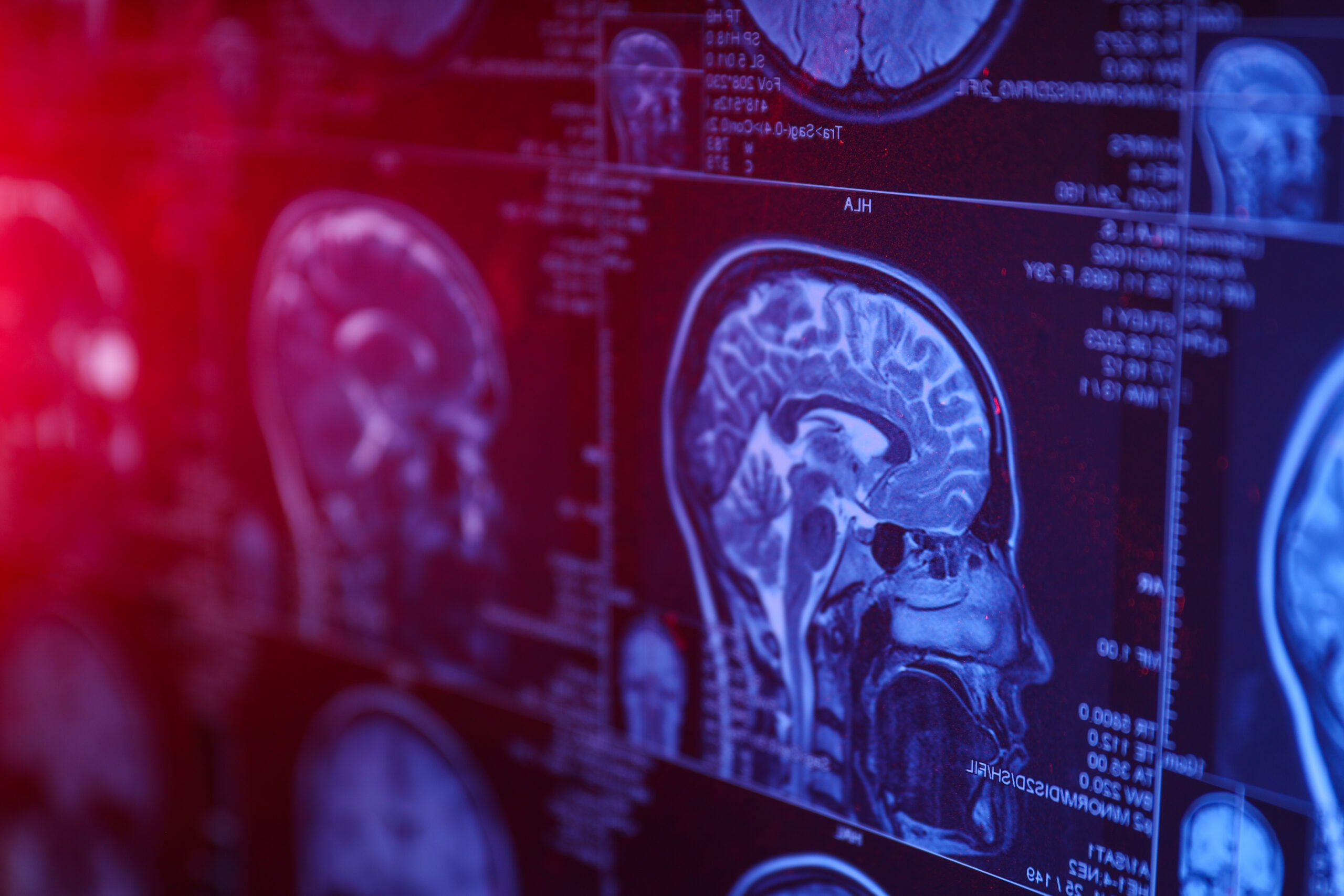 Brain scan images on a medical display in blue and red light